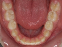 01-08--077-Lower Occlusal-01012006