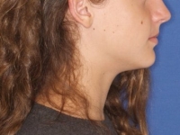 03-01--033-Right Profile-02072015