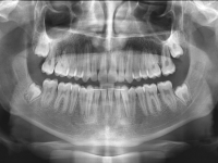 05-01-173-panoramic-xray-15012013