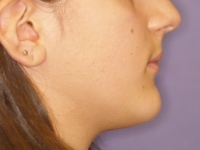 01-01-033-right-profile-24022010