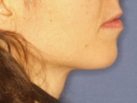 09-01--033-Right Profile-20022018