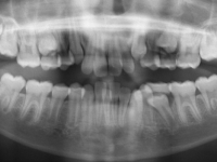 02-01-173-panoramic-xray-28062010