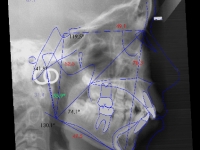 02-02-bjja-170-lateral-xray-28062010