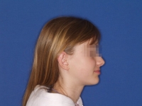 13-01--033-Right Profile-01012006.jpg