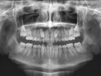 00-01-173-panoramic-xray-19012011