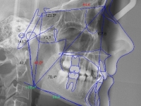 00-02-bjja-170-lateral-xray-19012011