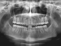 10-01-173-panoramic-xray-23072013