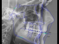 10-02-steiner-170-lateral-xray-23072013